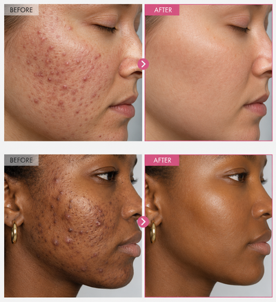 Korean Alpha-Arbutin Glow Cream